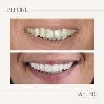 Dentist İrem Nur Özdemir Instagram 01