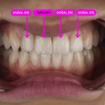 dentist İrem Nur Özdemir Instagram 04