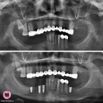 dentist İrem Nur Özdemir Instagram 05