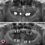 dentist İrem Nur Özdemir Instagram 06