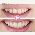 dentist İrem Nur Özdemir Instagram 07