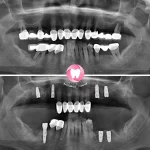 dentist İrem Nur Özdemir Instagram 08
