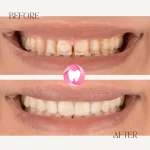 dentist İrem Nur Özdemir Instagram 09