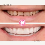 dentist İrem Nur Özdemir Instagram 10